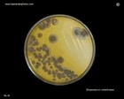 streptomyces growth on agar
